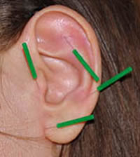 oreja
